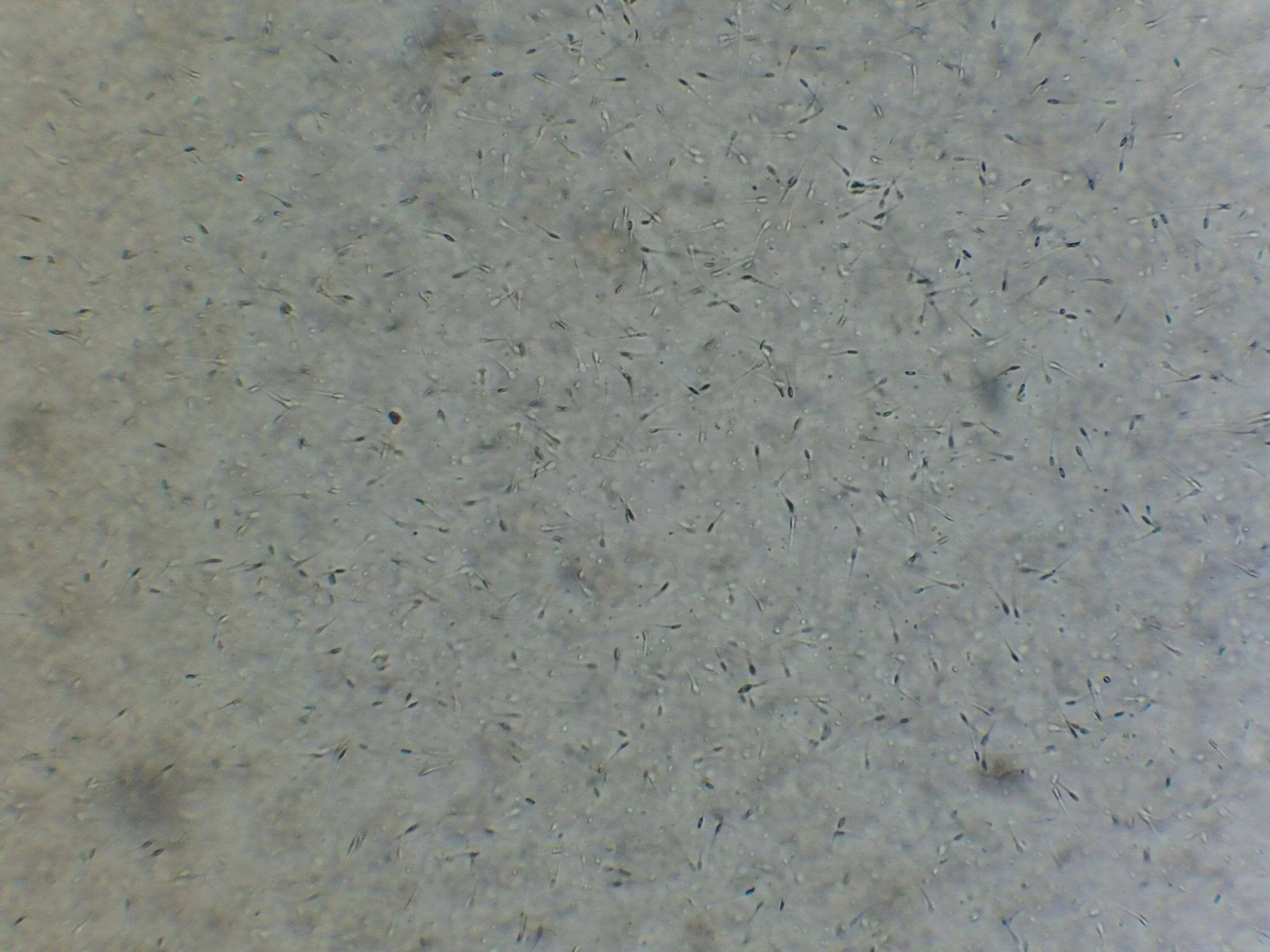 Vet Grade Canine Semen Analysis Microscope Kit 2500X - Image 5