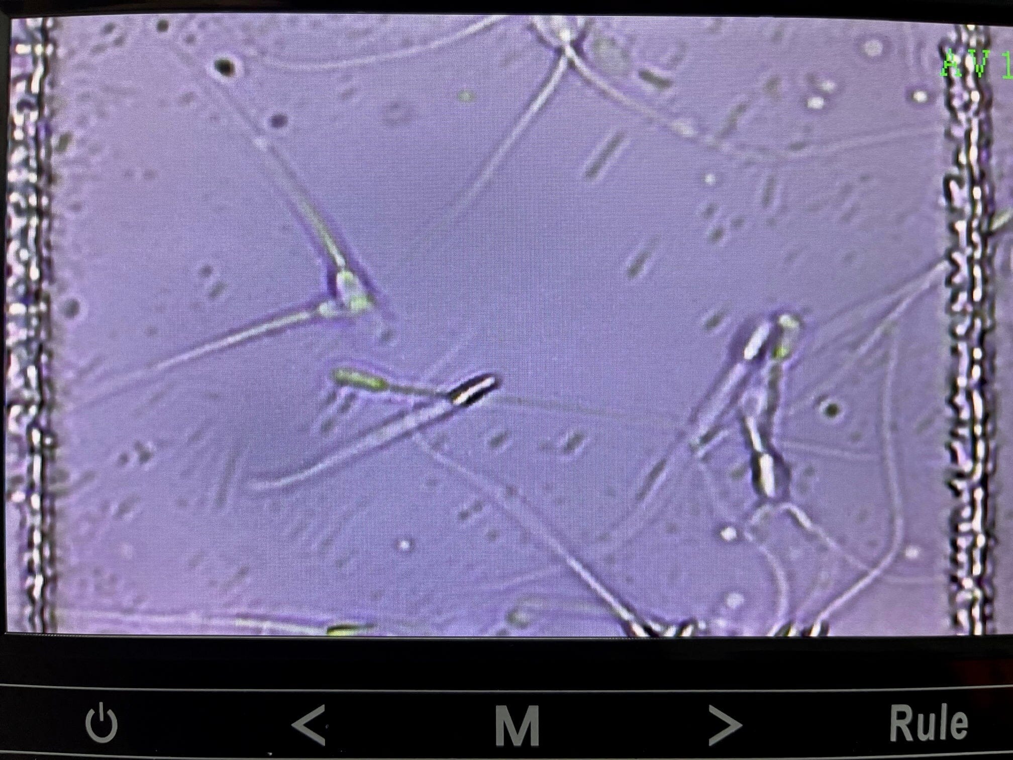 Cell-Vu Disposable Sperm Counting Chamber DRM-600 (50ct) - Image 5